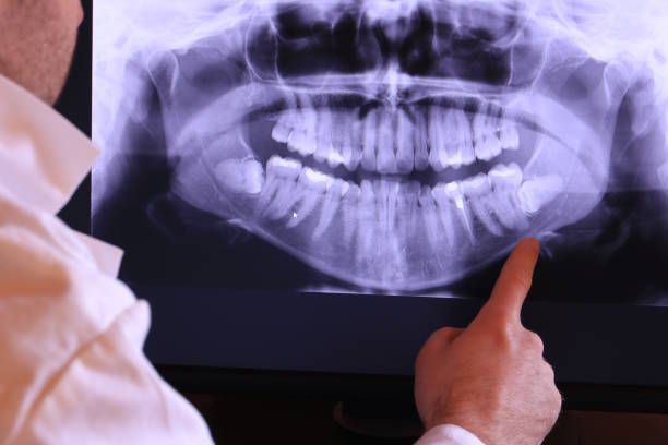 Best Emergency Tooth Extraction in East Palatka, FL